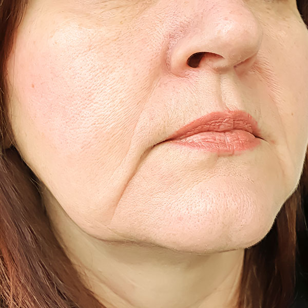 Discover Facial Contouring at Zia Cosmetic Clinic